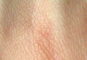 Dermatología y Dermatólogos